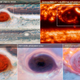 Blotches within Jupiter’s Great Red Spot